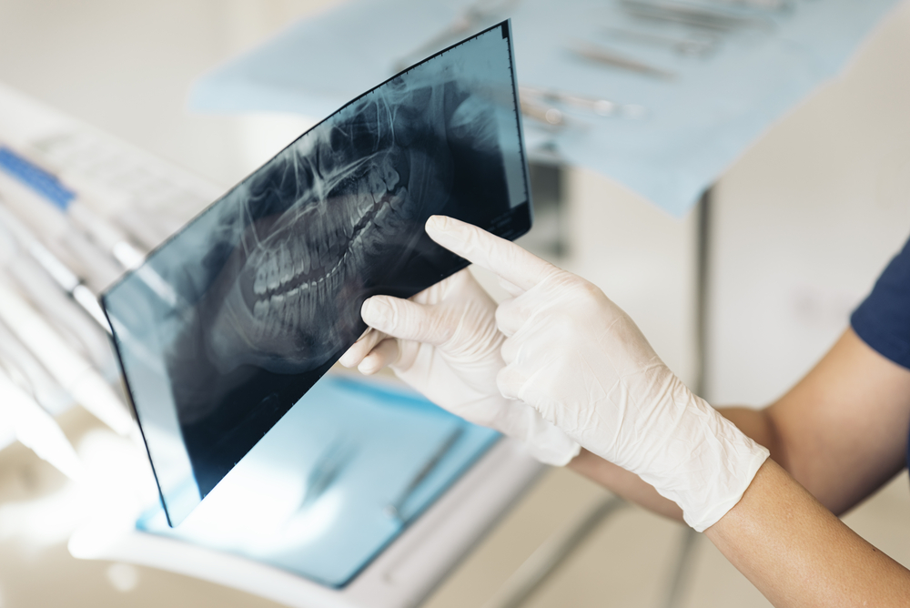 tomografia odonto